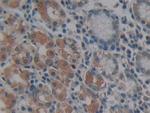 MMP14 Antibody in Immunohistochemistry (Paraffin) (IHC (P))