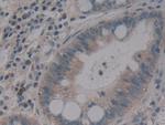 MMP14 Antibody in Immunohistochemistry (Paraffin) (IHC (P))