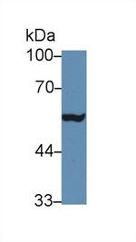 MMP24 Antibody in Western Blot (WB)