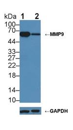 MMP9 Antibody in Western Blot (WB)