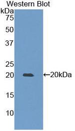 MMP9 Antibody in Western Blot (WB)