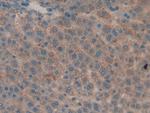 MMP9 Antibody in Immunohistochemistry (Paraffin) (IHC (P))