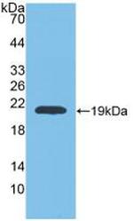 MMP9 Antibody in Western Blot (WB)