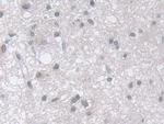 MPP5 Antibody in Immunohistochemistry (Paraffin) (IHC (P))