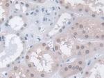 MPP5 Antibody in Immunohistochemistry (Paraffin) (IHC (P))