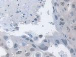 MPP5 Antibody in Immunohistochemistry (Paraffin) (IHC (P))