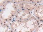 MAT2A Antibody in Immunohistochemistry (Paraffin) (IHC (P))