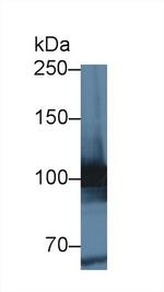 MARS Antibody in Western Blot (WB)