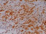 MUC2 Antibody in Immunohistochemistry (Paraffin) (IHC (P))