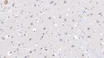 MYH7 Antibody in Immunohistochemistry (Paraffin) (IHC (P))