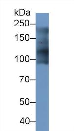 MYH7 Antibody in Western Blot (WB)