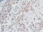 MYO1D Antibody in Immunohistochemistry (Paraffin) (IHC (P))