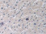 MX1 Antibody in Immunohistochemistry (Paraffin) (IHC (P))