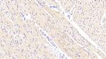 NDUFS1 Antibody in Immunohistochemistry (Paraffin) (IHC (P))