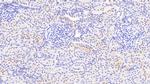 NDUFS1 Antibody in Immunohistochemistry (Paraffin) (IHC (P))