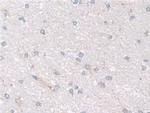 NDUFS1 Antibody in Immunohistochemistry (Paraffin) (IHC (P))