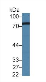 NDUFS1 Antibody in Western Blot (WB)