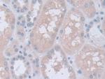 INVS Antibody in Immunohistochemistry (Paraffin) (IHC (P))