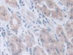 INVS Antibody in Immunohistochemistry (Paraffin) (IHC (P))