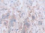 INVS Antibody in Immunohistochemistry (Paraffin) (IHC (P))