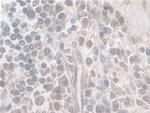 Nesprin 2 Antibody in Immunohistochemistry (Paraffin) (IHC (P))