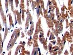 Nexilin Antibody in Immunohistochemistry (Paraffin) (IHC (P))