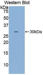 NOSIP Antibody in Western Blot (WB)