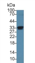 NOSIP Antibody in Western Blot (WB)