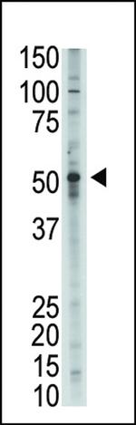 BMP9 Antibody in Western Blot (WB)