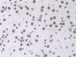 NPM1 Antibody in Immunohistochemistry (Paraffin) (IHC (P))