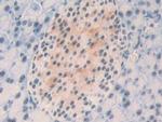 NPM1 Antibody in Immunohistochemistry (Paraffin) (IHC (P))