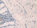 NPM1 Antibody in Immunohistochemistry (Paraffin) (IHC (P))