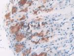 NPM1 Antibody in Immunohistochemistry (Paraffin) (IHC (P))