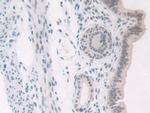 NPM1 Antibody in Immunohistochemistry (Paraffin) (IHC (P))