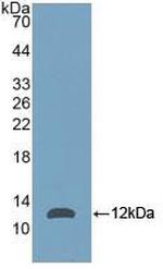 NPM1 Antibody in Western Blot (WB)