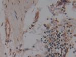 NUP155 Antibody in Immunohistochemistry (Paraffin) (IHC (P))