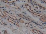 NUP155 Antibody in Immunohistochemistry (Paraffin) (IHC (P))