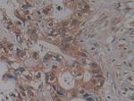 NUP155 Antibody in Immunohistochemistry (Paraffin) (IHC (P))