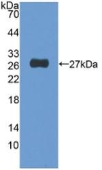 NUP155 Antibody in Western Blot (WB)