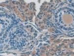 NXN Antibody in Immunohistochemistry (Paraffin) (IHC (P))