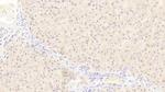 NUMB Antibody in Immunohistochemistry (Paraffin) (IHC (P))