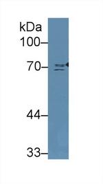 NUMB Antibody in Western Blot (WB)