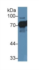 NUMB Antibody in Western Blot (WB)