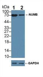 NUMB Antibody in Western Blot (WB)