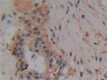 PAK2 Antibody in Immunohistochemistry (Paraffin) (IHC (P))