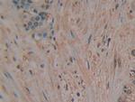 PAK2 Antibody in Immunohistochemistry (Paraffin) (IHC (P))