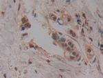 PAK2 Antibody in Immunohistochemistry (Paraffin) (IHC (P))