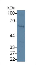 PAK2 Antibody in Western Blot (WB)