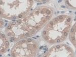 Palladin Antibody in Immunohistochemistry (Paraffin) (IHC (P))