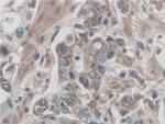 Palladin Antibody in Immunohistochemistry (Paraffin) (IHC (P))